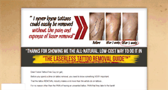 Desktop Screenshot of laserlesstattooremoval.com