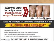 Tablet Screenshot of laserlesstattooremoval.com